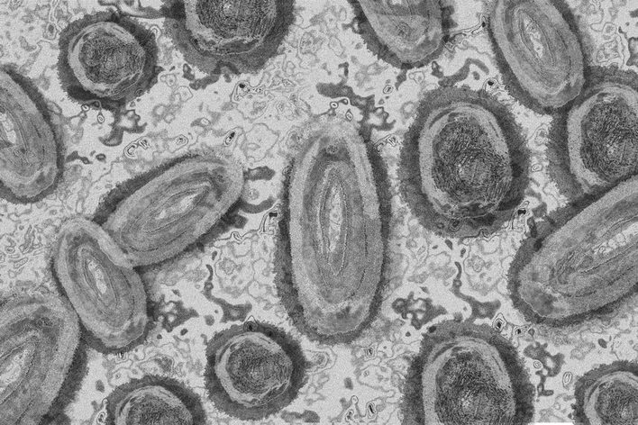 Mpox/Affenpocken unter dem Mikroskop.