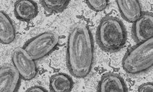 Mpox/Affenpocken unter dem Mikroskop.